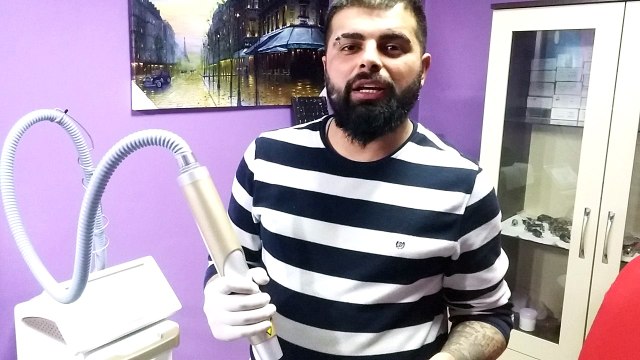 Magic Dövme silimi Sakarya dövme silimi dövme silen yerler Barış yüksek