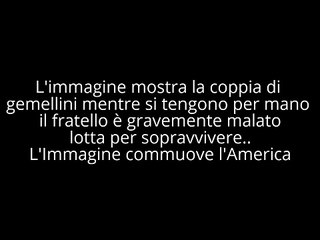 Mason e Madilyn i gemelli che si tengono per mano in Ecografia (720p Full HD)