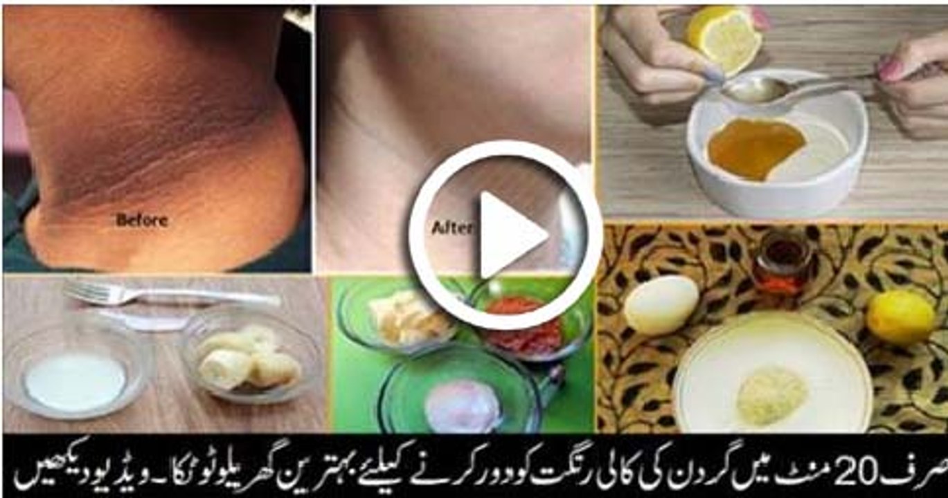 Dark Neck Remove In 20 Minutes For Girls