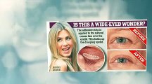 Eye Secrets eye lift tape vorher nachher Fotos