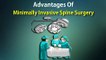 Advantages Of Minimally Invasive Spine Surgery