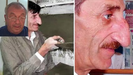 Самый длинный нос в мире