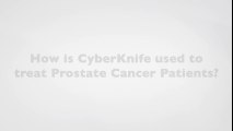 How Is CyberKnife Used to Treat Prostate Cancer Patients