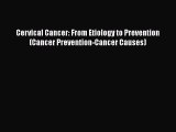 [PDF] Cervical Cancer: From Etiology to Prevention (Cancer Prevention-Cancer Causes) [Download]