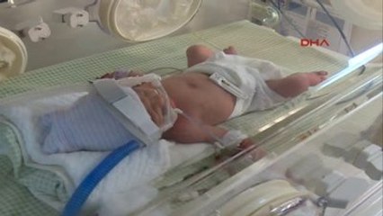 Dördüz Bebeklerini Beklerken İşsiz Kaldı