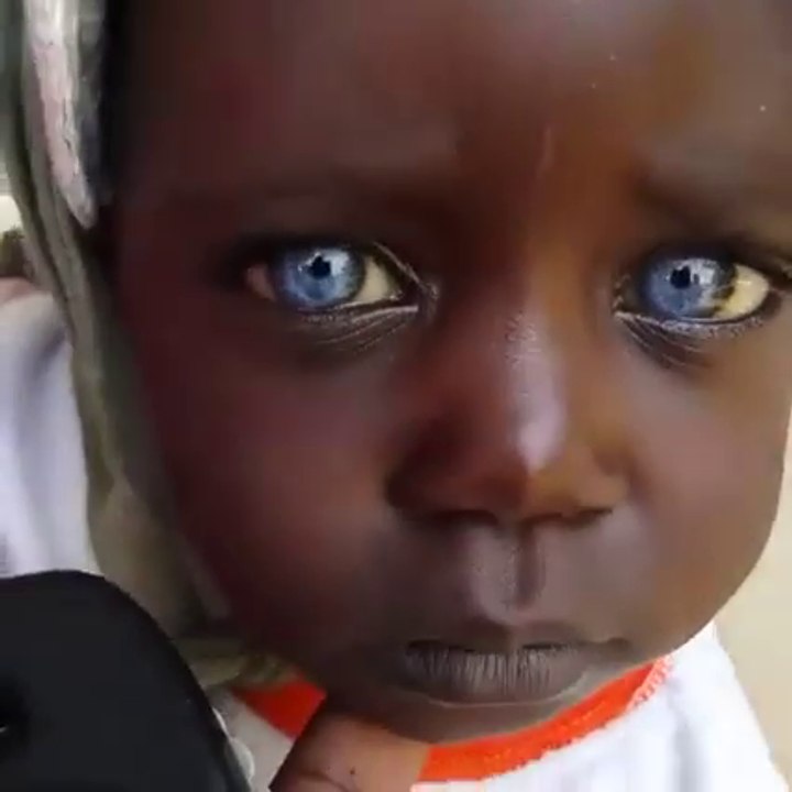 Une Enfant Noire Aux Yeux Bleus Video Dailymotion