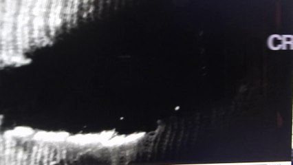 CRISIS ACTORS: Asking For Seconds