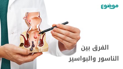 الفرق بين الناسور والبواسير