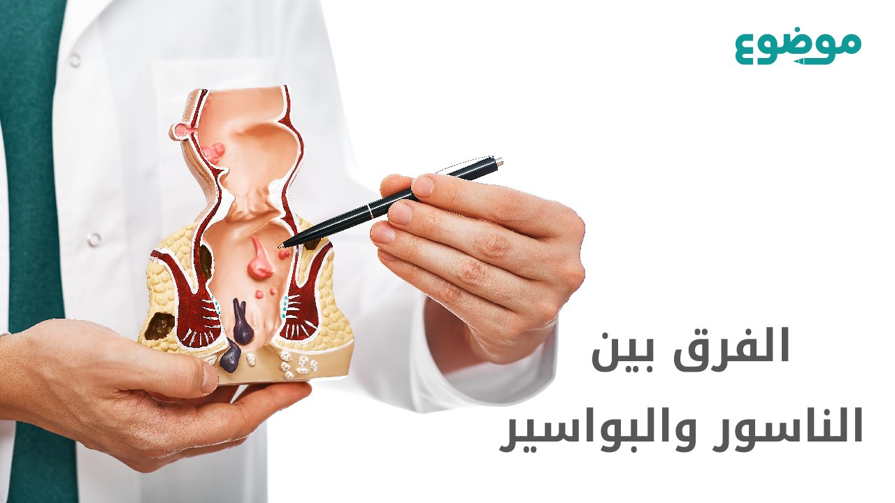 الفرق بين الناسور والبواسير