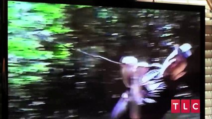 The Man With A Hole In His Face Body Bizarre Episode 2