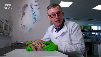 Up close with a human brain - BBC News