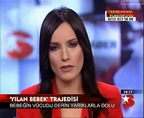 Adana'da Doğan Yılan Bebek Tüm Dünyayı Hayrete Düşürdü
