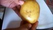 how to remove dark circles Potato for dark circles under eyes - Simple home remedy for dark circles under eyes - beauty