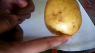 Potato for dark circles under eyes - Simple home remedy for dark circles under eyes - YouTube