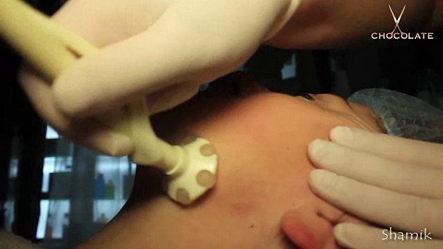 Процедура Скин - Лифт лица - Лифтинг лица и профилактика старения