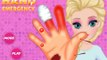 Disney Frozen Games - Elsa Hand Emergency – Best Disney Princess Games For Girls And Kids