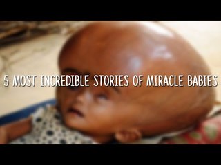 5 Most Shocking & Yet Amazing Stories of Miracle Babies!