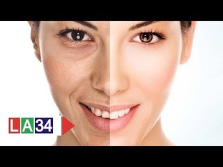 Phụ nữ sau 25, ngừa lão hóa da thế nào? | LATV