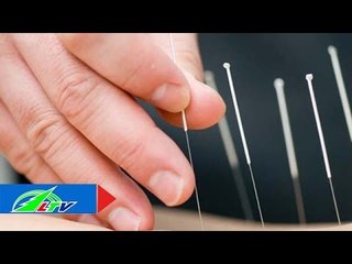 Điều trị đau lưng bằng châm cứu: Có hiệu quả? | LTV