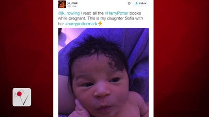 Mom Read Harry Potter Books While Pregnant, Baby Born with Magical Birthmark