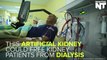 Artificial Kidney Could Free Patients From Dialysis