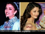 Aishwarya Rai hatte, Plastische Chirurgie, vor und nach Fotos