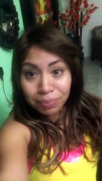 Bichectomia /hrs Despues