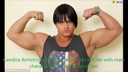 Steroids turned me into man! Female bodybuilder's habit left her with Organ & Facial hair