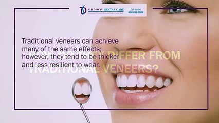 How Can Lumineers Enhance or Improve Your Smile