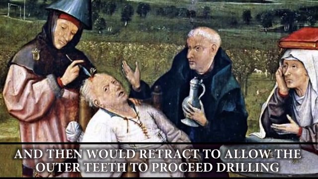 The Most Terrifying Medical Instruments In History (2)