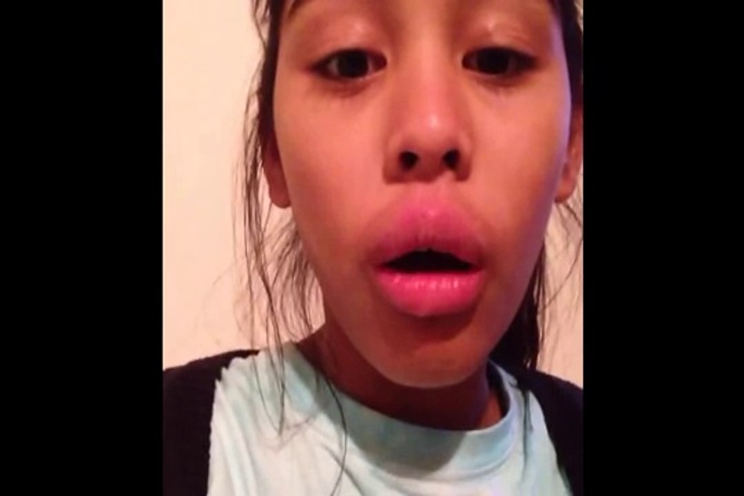 Kylie Jenner Lips Challenge Vines Compilation - Kylie Jenner Challenge Fails Compilation