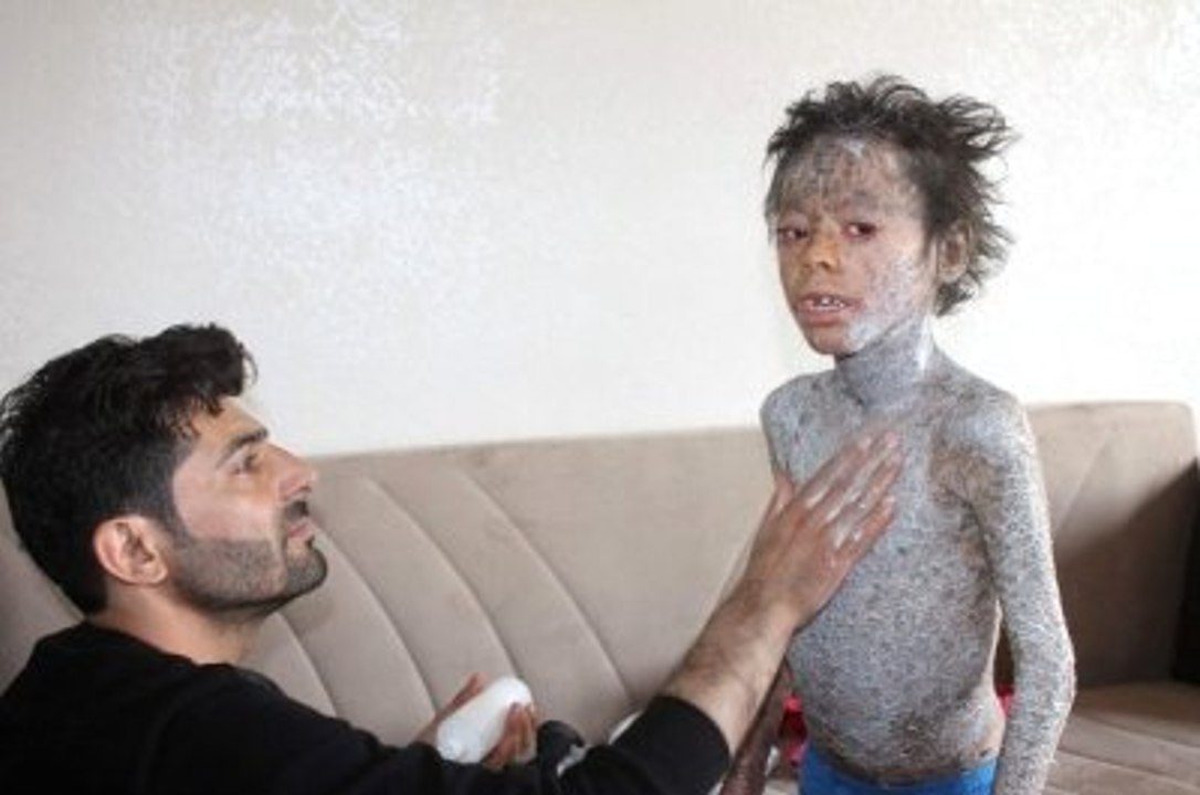 Küçük Melih'in Dramı Yürek Burkuyor: Herkes Benden Korkuyor!