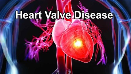 What Is Heart Valve Disease? || Healthy Heart Tips