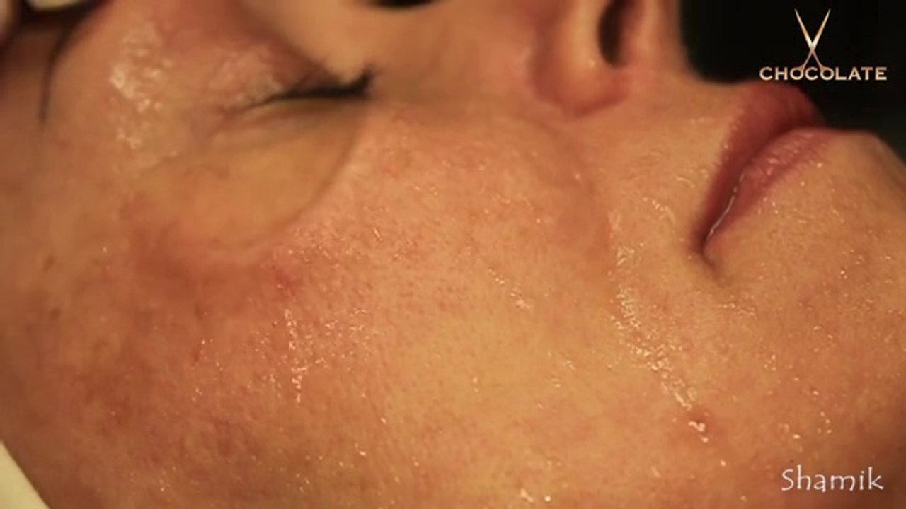 Кислородная чистка лица. Кислородный пилинг. Кислородотерапия