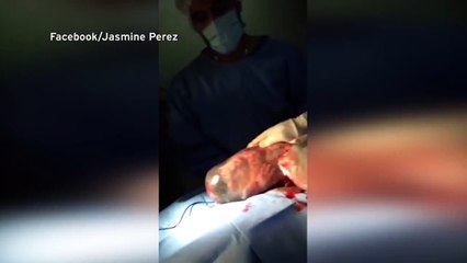 Ce bébé est né avec son sac amniotique !