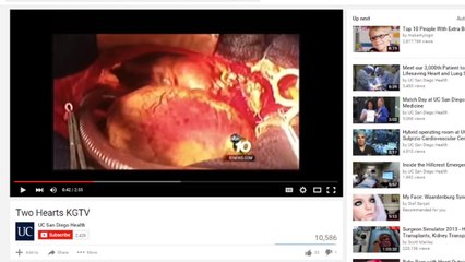 Top 10 People With Extra Body Parts