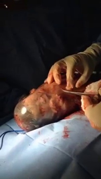Une naissance incroyable