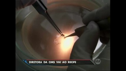 Diretora da OMS vai a Pernambuco, estado com maior número de casos de microcefalia