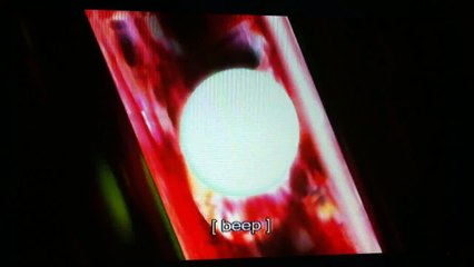 Ben 10 Ultimate Alien Swampfire(Methanosian) Transformation