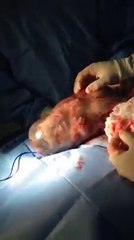 Un bébé vient au monde dans son sac amniotique