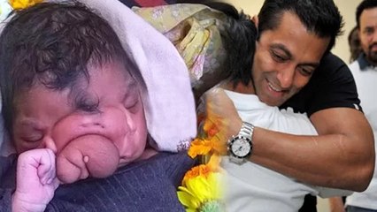 Tải video: Salman Khan Donates 40 LAKHS For 2 Head Baby Surgery