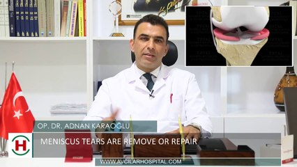 Avcilar Hospital - Knee pain and treatment! Op. Dr. Adnan KARAOGLU- Orthopedist