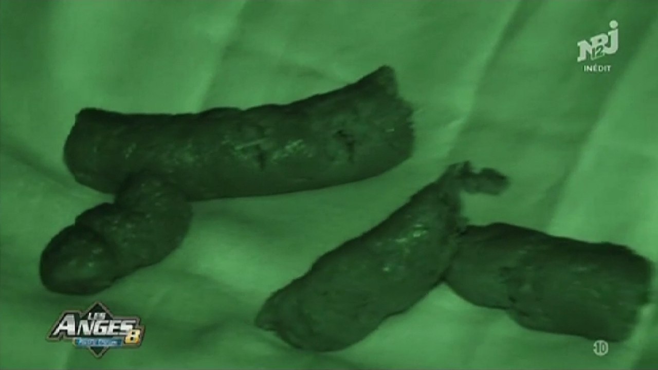 Zapping du 26 février 2016 - Du caca chez les anges !