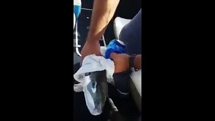 Bu Balığın Dişlerine Dikkat! Yok Böyle Bir Şey