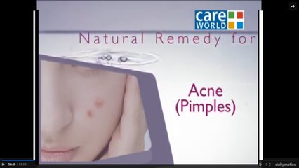 New And Very Easy Tip For Pimples Must Watch