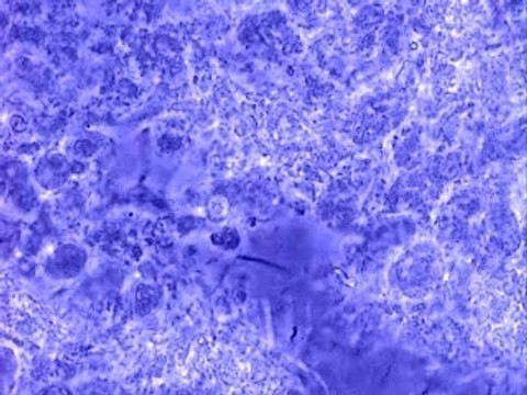 Recherche amibes orales