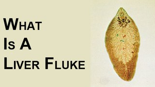 What is a Liver Fluke