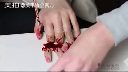 OMG - Cute Girl cut her Fingers and injured badly