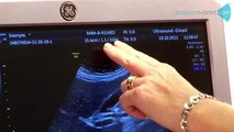 General Imaging Ultrasound Scans