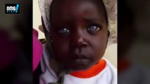 A black child with blue eyes - Ένα μαύρο κοριτσάκι με μπλε σπάνια μάτια